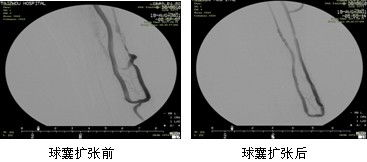 台州医院